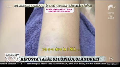 Riposta fostului iubit al Andreei Podărescu! "Dacă spune că am bătut-o de ce nu m-a reclamat la Poliţie"