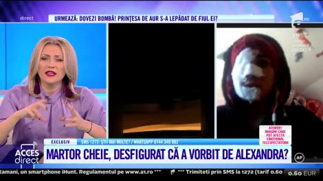 Acces Direct. O femeie ar fi fost desfigurată în bătaie de soţul albanez, după ce a dat detalii despre posibila locaţie în care ar fi fost ţinută Alexandra Măcenașu