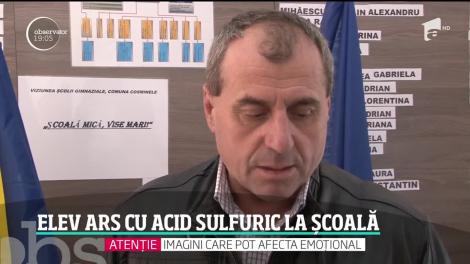 Un elev din Prahova a fost ars cu acid sulfuric, după ce a mutat un dulap cu substanţe chimice din clasă. Băiatul a avut nevoie de transplant de piele