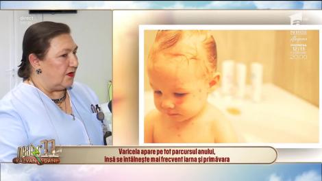 Ce trebuie să ştii despre varicelă - una dintre cele mai frecvente boli ale copilăriei