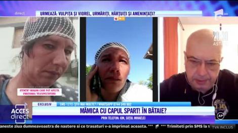 I-a spart capul cu prăjina! O femeie din Călărași a fost atacată din senin de vecina sa