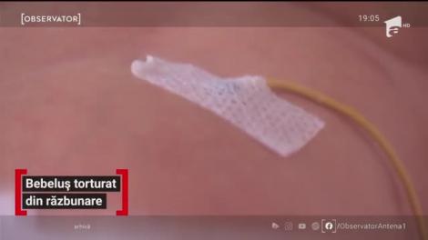 Și-a torturat bebelușul provocându-i traumatisme cerebrale grave deoarece bănuia că  nu este al lui! Medicii sunt rezervați, minorul se zbate între viață și moarte