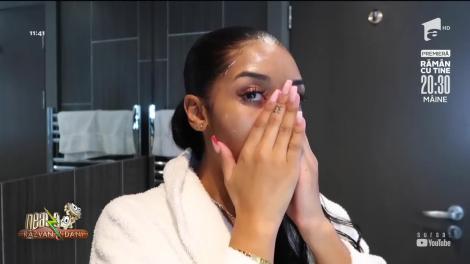 Botoxul natural, metoda sigura care te scapă de riduri