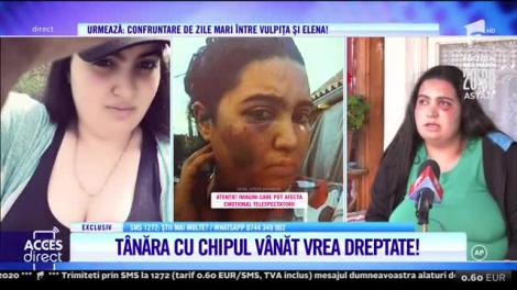 Tânăra desfigurată în bătaie vrea dreptate: M-a lovit fără motiv, doar de dragul de a bate pe cineva!