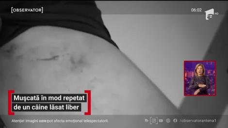 O tânără de 15 ani din Constanţa, mușcată în mod repetat de un câine lăsat liber