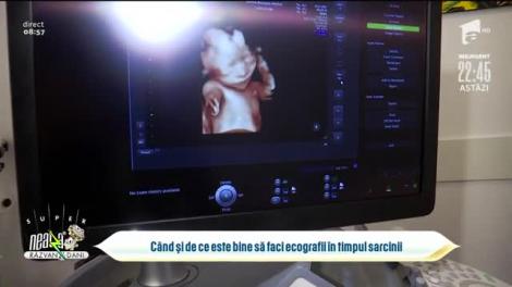 Când și de ce este bine să faci ecografii în timpul sarcinii