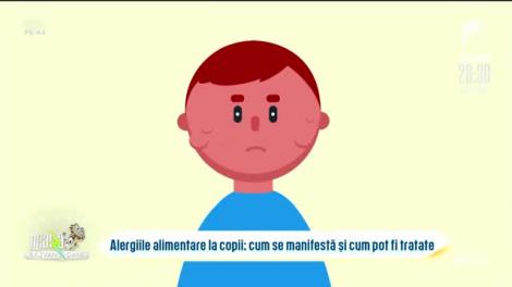 Bună dimineața, sănătate! Alergiile alimentare la copii - cum se manifestă și cum trebuie tratate