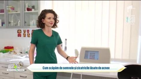 Cum scăpăm de semnele și cicatricile lăsate de acnee