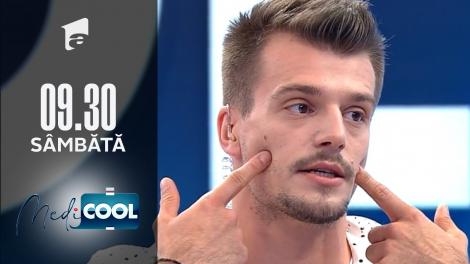 Medicool sezonul 1, 20 noiembrie 2021. Cum tratăm bruxismul