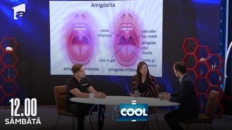 Medicool sezonul 2, 27 mai 2022. Când se scot amigdalele copiilor