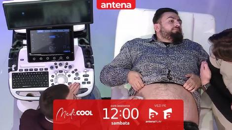 MediCOOL sezonul 4, 11 februarie 2022. Cât de gras este ficatul tău? Sfaturi de la medicul Theodor Voiosu
