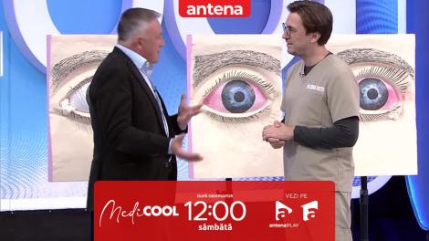 Medicool sezonul 4, 1 aprilie 2023. Cele mai frecvente afecțiuni ale ochilor