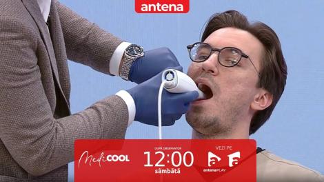 Medicool sezonul 4, 8 aprilie 2023. Totul despre scanarea digitală a danturii