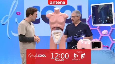 Medicool sezonul 4, 20 mai 2023. Cum se realizează o colonoscopie