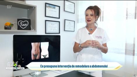 Super Neatza, 19 iunie 2023. Ce presupune intervenția de remodelare a abdomenului