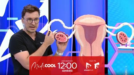Medicool sezonul 5, 16 septembrie 2023. De ce se subțiază firul de păr în urma menopauzei
