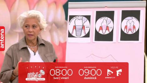 Super Neatza,  26 octombrie 2023. De ce apare paratondoza și cum o putem trata