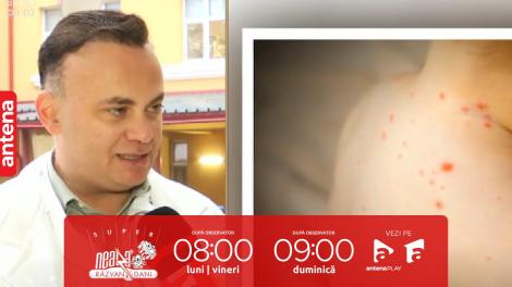 Super Neatza, 7 decembrie 2023. Epidemie de rujeolă la nivel național