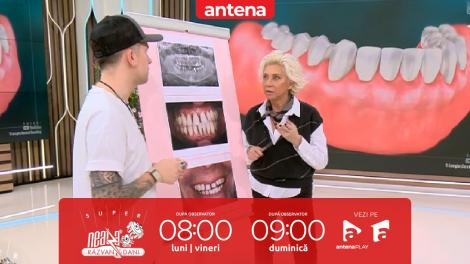 Super Neatza, 21 martie 2024. Cum se realizează estetica dentară în caz de retracție gingivală