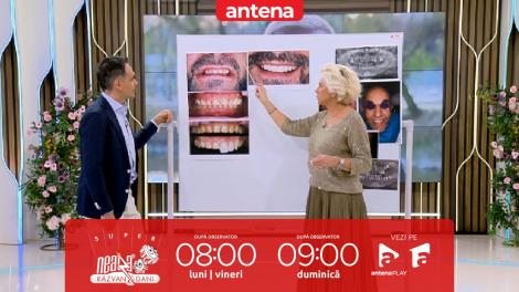 Super Neatza, 18 aprilie 2024. Ce este abraziunea dentara. Cauze și tratament