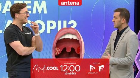 Medicool sezonul 6, 18 mai 2024. Controverse medicale: Se scot sau nu amigdalele