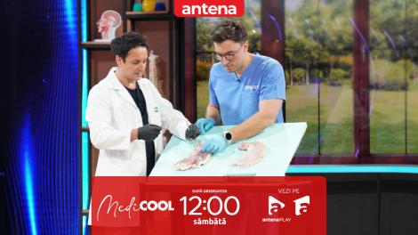 Medicool sezonul 8, 19 aprilie 2025. Ce poate cauza ulcerul gastric