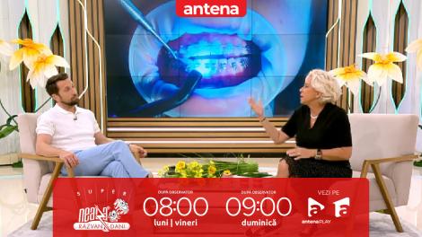 Super Neatza, 24 aprilie 2025. Aparatul dentar. Între estetică și sănătate orală