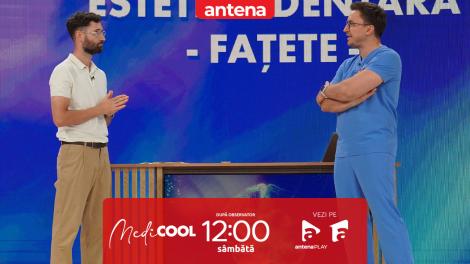 Medicool sezonul 8, 17 mai 2025. Când merită să-ți pui fațete dentare: Beneficii, riscuri și recomandări