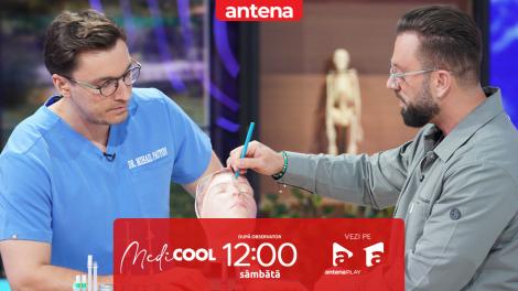 Medicool sezonul 8, 17 mai 2025. Intervențiile cu toxina botulinică: De la estetică la tratamente medicale