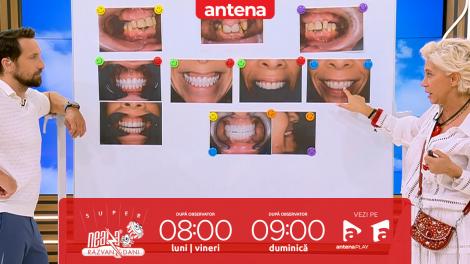 Super Neatza, 3 iulie 2025. Consecințele amânării mersului la stomatolog