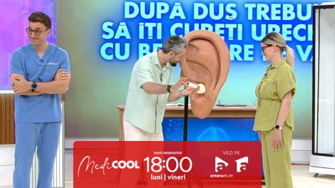 Medicool sezonul 9, 16 septembrie 2025. Mit sau adevăr. Este bine sa ne curățăm urechile cu beţişoare?