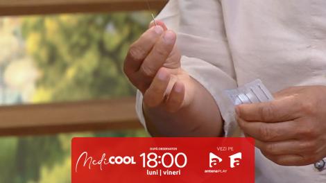 Medicool sezonul 9, 23 septembrie 2025. Ce este acupunctura, terapia care te poate scăpa de dureri