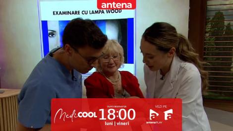 Medicool sezonul 9, 25 septembrie 2025. Petele de pe corp: ce dezvăluie un simplu test