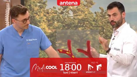 Medicool sezonul 9, 30 septembrie 2025. Prăjeala și sănătatea inimii: pericolul ascuns pentru vasele de sânge