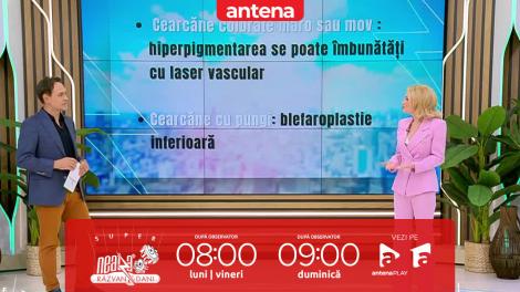 Super Neatza, 6 octombrie 2025. Ce soluții are estetica modernă pentru cearcănele care nu dispar