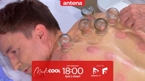 Medicool sezonul 9, 14 octombrie 2025. Totul despre terapia cu ventuze
