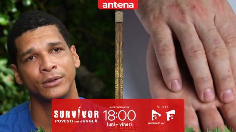 Survivor - Povești din Junglă, 22 ianuarie 2026. Cum apar erupțiile pe pielea concurenților?