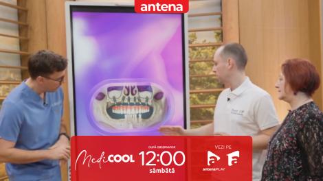 Medicool | Sezonul 10. De ce sunt necesare adițiile de os?
