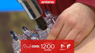 Medicool | Sezonul 10. Masajul cu ventuze: cum funcționează și când poate ajuta