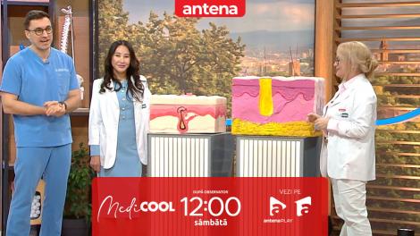 Medicool | Sezonul 10. Cum decurge un transplant de păr? Medicii explică procedura pas cu pas
