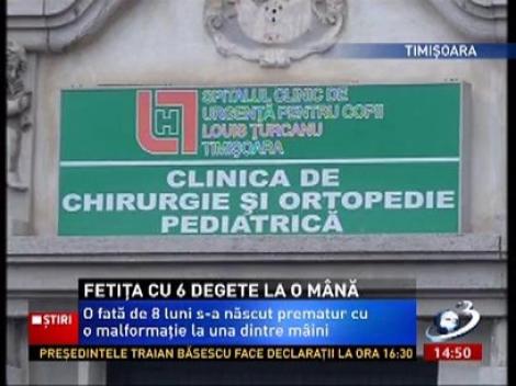 O fetiţă din timişoara s-a născut cu 6 degete la o mână. Sora ei geamănă este perfect sănătoasă