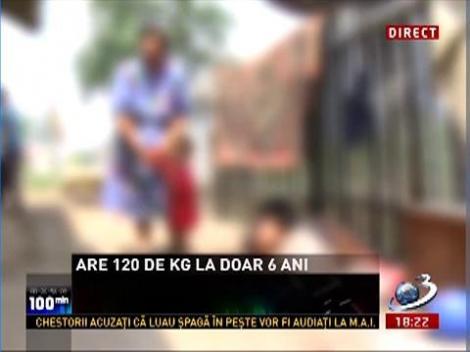 Un copil de şase ani din Dolj cântăreşte 120 de kg