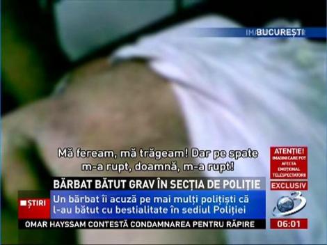 Un bărbat a fost bătut cu bestialitate de poliţişti, într-o secţie din Bucureşti