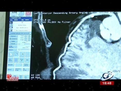 Spitalul Monza, centru de excelență în Chirurgie Cardiovasculara