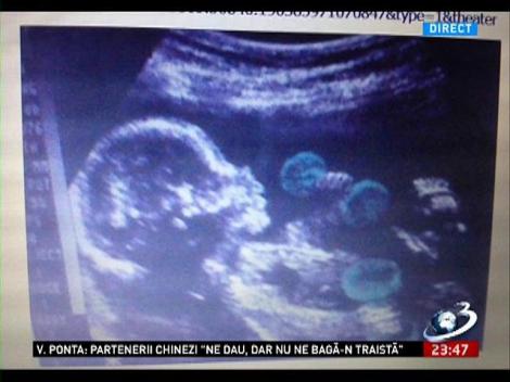 Premieră mondială! Mircea Badea arată prima ecografie cu copilul său