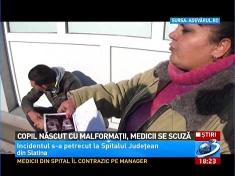 Caz socant la Spitalul Judetean Slatina! Copil nascut cu malformatii, medicii se scuza