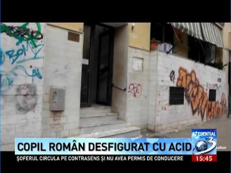 Copil de doi ani, desfigurat cu acid