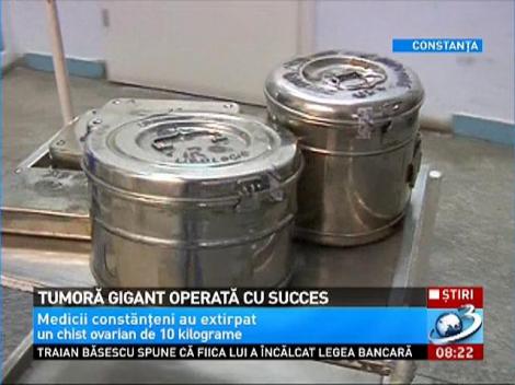 Medicii din Constanţa au extirpat un chist ovarian de 10 kilograme