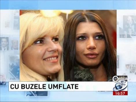 Deziluzia Optică:  Cu buzele umflate