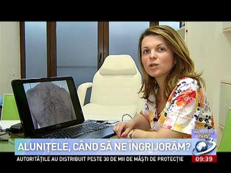 Numai de bine: Alunițele, când să ne îngrijoreze?